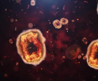 Mpox: conheça os sintomas, os tratamentos e saiba como se prevenir